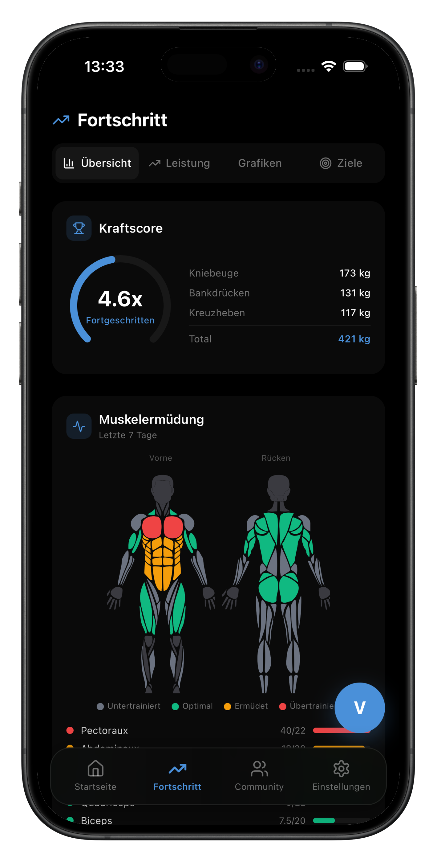 Fortschrittsverfolgung AIVancePro